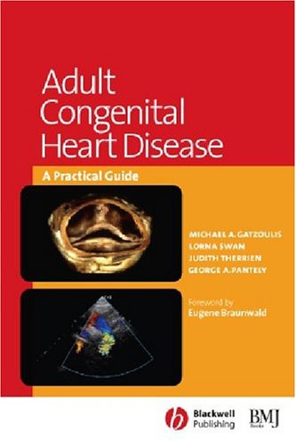 Adult Congenital Heart Disease: A Practical Guide